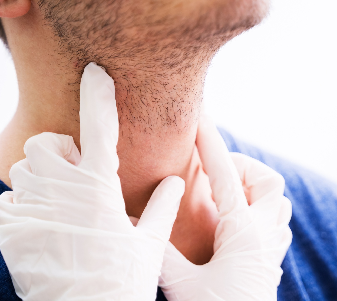 Chirurgie des glandes salivaires | chirurgien maxillo facial | Institut du visage | Bordeaux
