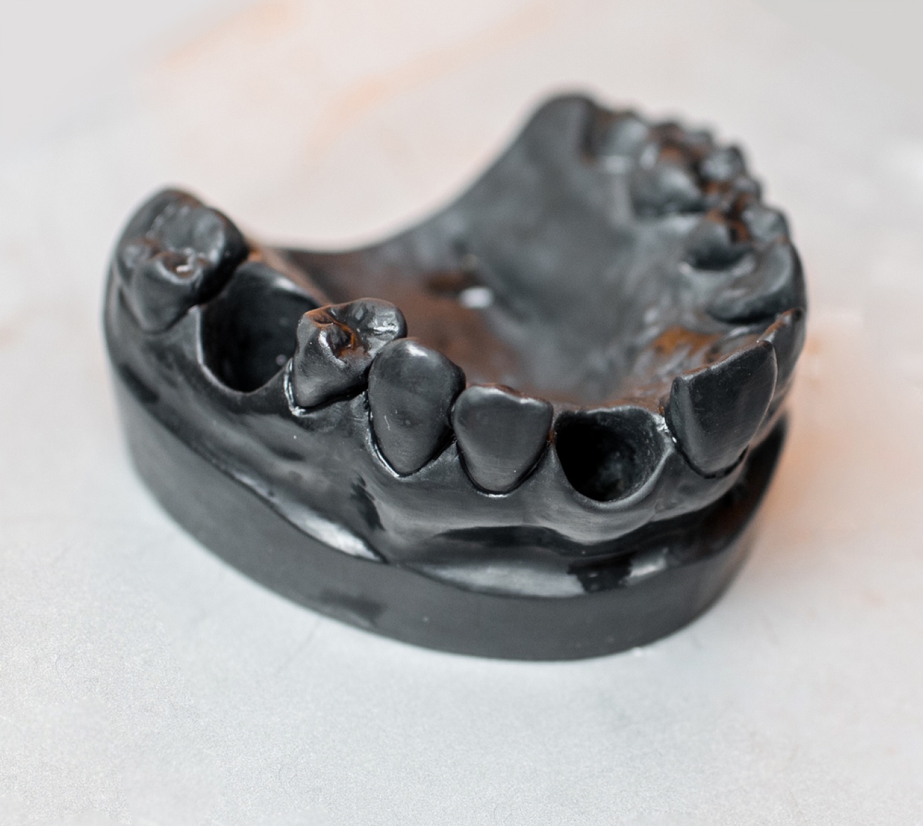 Materialise : impression 3D | centre de chirurgie maxillo facial | Institut du visage | Bordeaux