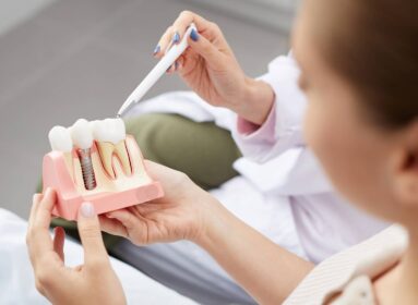 À qui s’adresse la pose d’implant dentaire ? | Institut Chirurgie du visage | Bordeaux